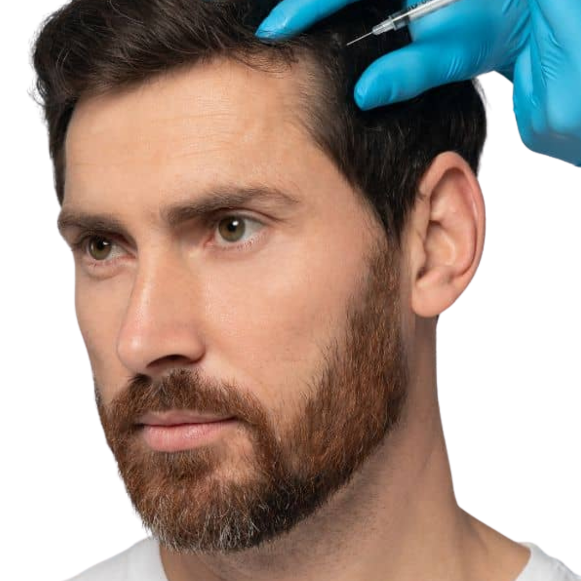 Plasma Rico en Plaquetas capilar + Megadosis Vitaminas Hair Vital Boost 1