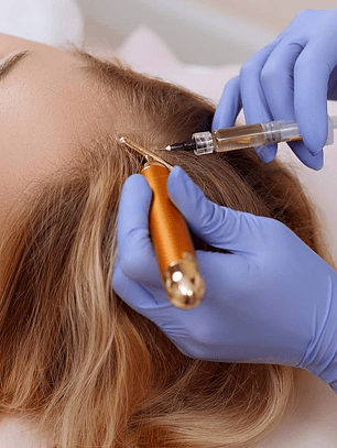 Plasma Rico en Plaquetas capilar 