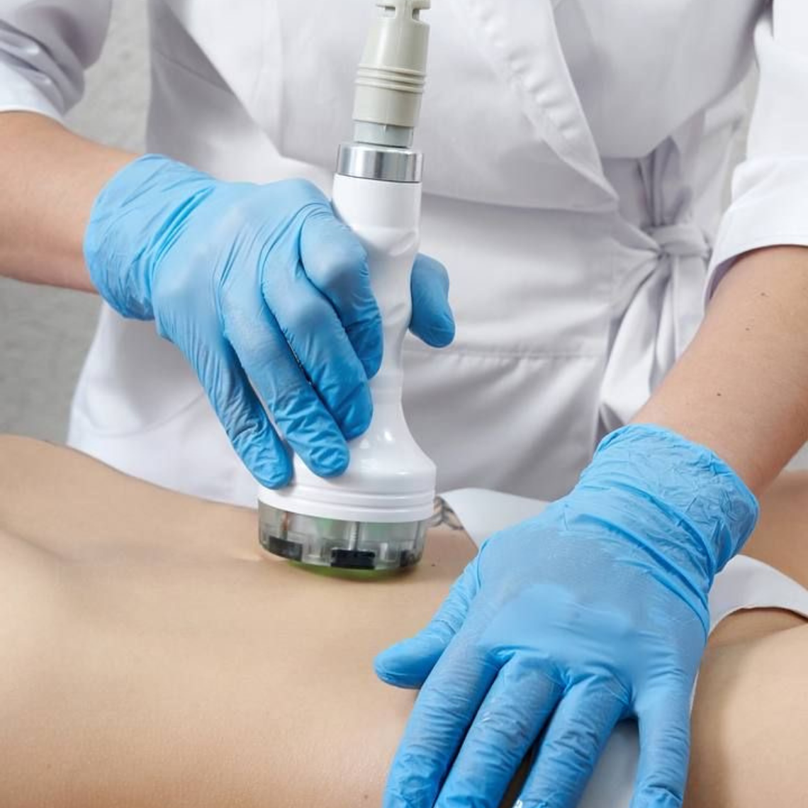 Radiofrecuencia corporal 1 zona - 8 sesiones 1