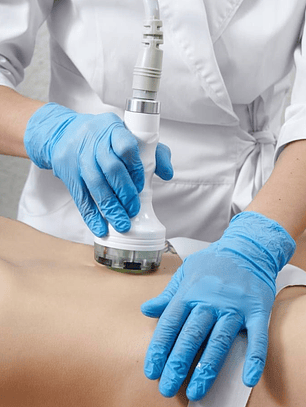 Radiofrecuencia corporal 1 zona - 8 sesiones