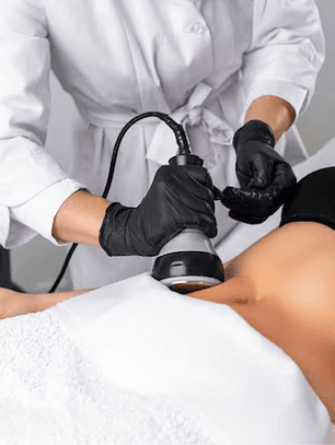 Cavitación - 10 sesiones