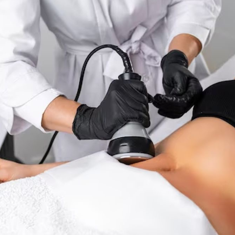 Cavitación - 10 sesiones 1