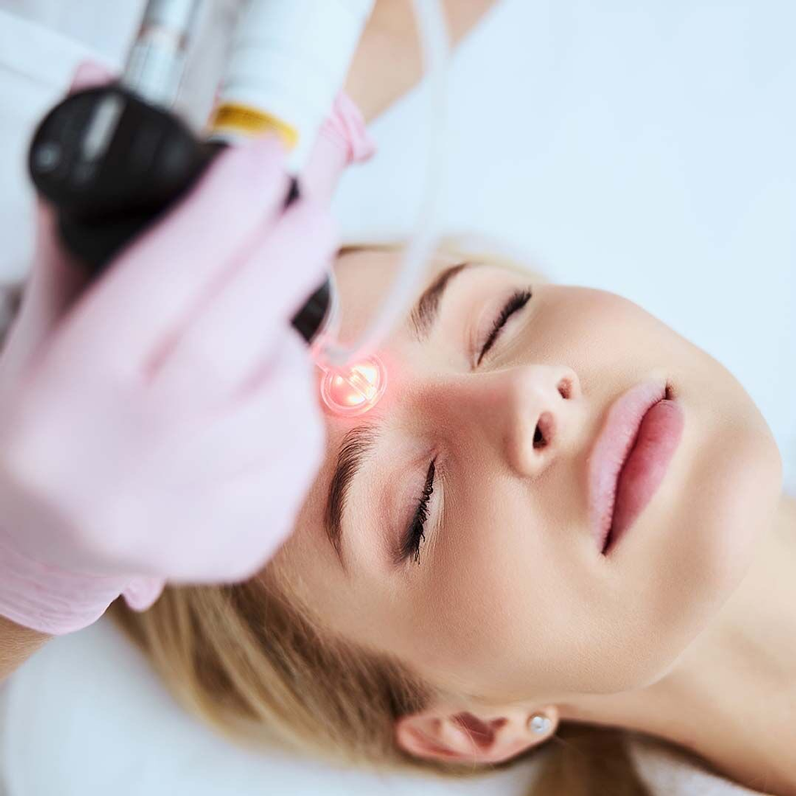 Tratamiento de cicatrices con Láser CO2 1