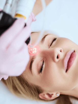 Tratamiento de cicatrices con Láser CO2