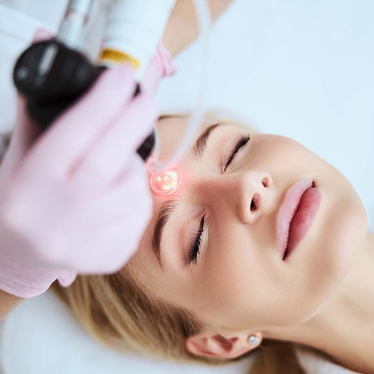 Tratamiento de cicatrices con Láser CO2 1