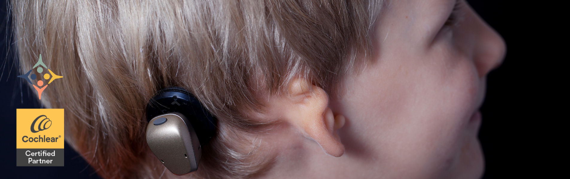 Osia®, un nuevo implante de conducción ósea de Cochlear.