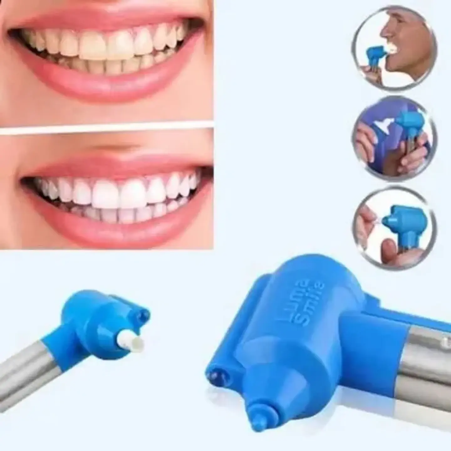 Pulidor y Blanqueador Dental Luma Smile - Sonrisa Blanca en Minutos 4