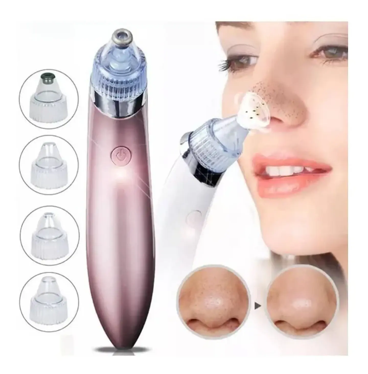 REMOVEDOR EXTRACTOR DE PUNTOS NEGROS E IMPUREZAS 4