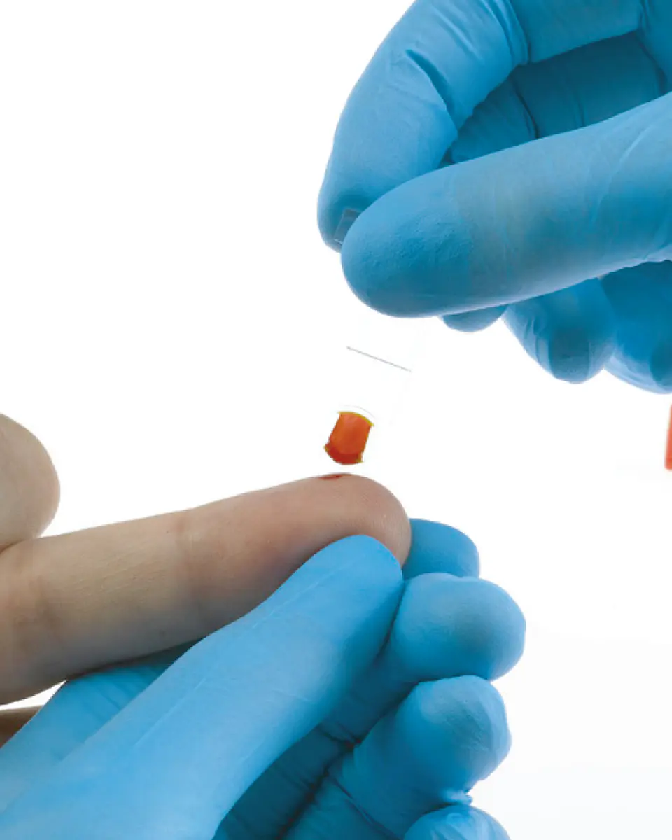 Hemoglobinómetro Hemo_Control | EKF 4