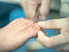 Fisioterapia