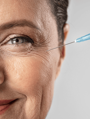 Toxina Botulínica (3 zonas - 18 puntos)