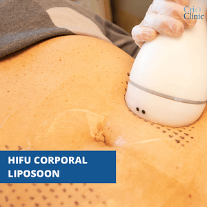 HIFU 3D CORPORAL – LIPOSOON