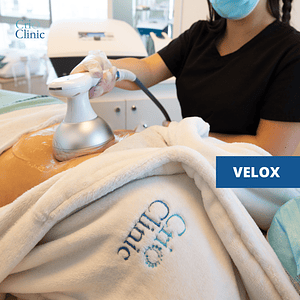 VELOX