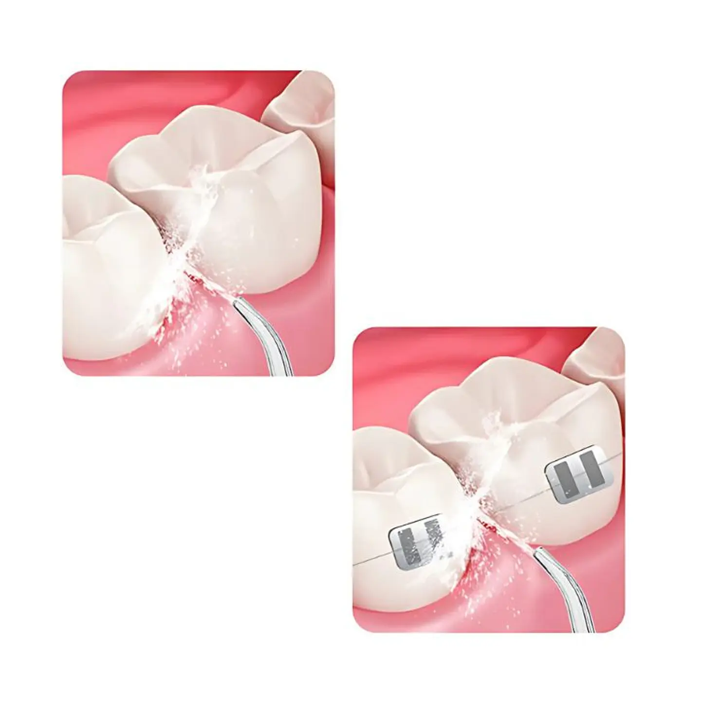 Limpiador Dental Portatil USB Irrigador Bucal 7