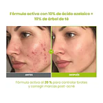 AZELAIC ACID 10 KOJIC TEA TREE