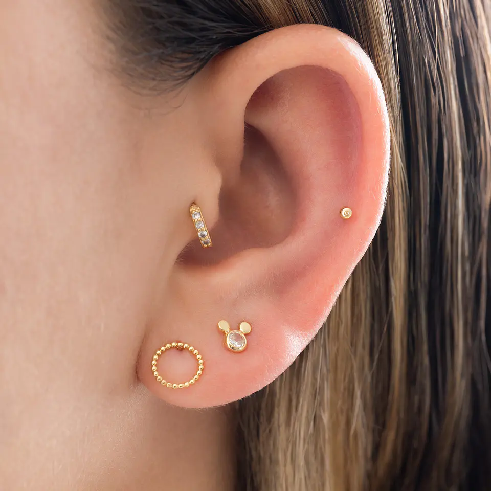 Arete Roma 2