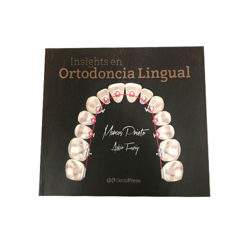 Libro Ortodoncia Lingual Arco Recto