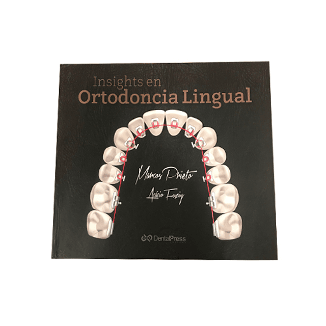 Libro Ortodoncia Lingual Arco Recto