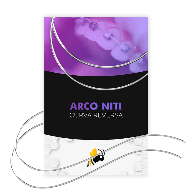 Arco Niti Curva Rev Red. OV- 2/Pack