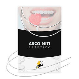 Arco Niti Red Estético OV- 1/Pack