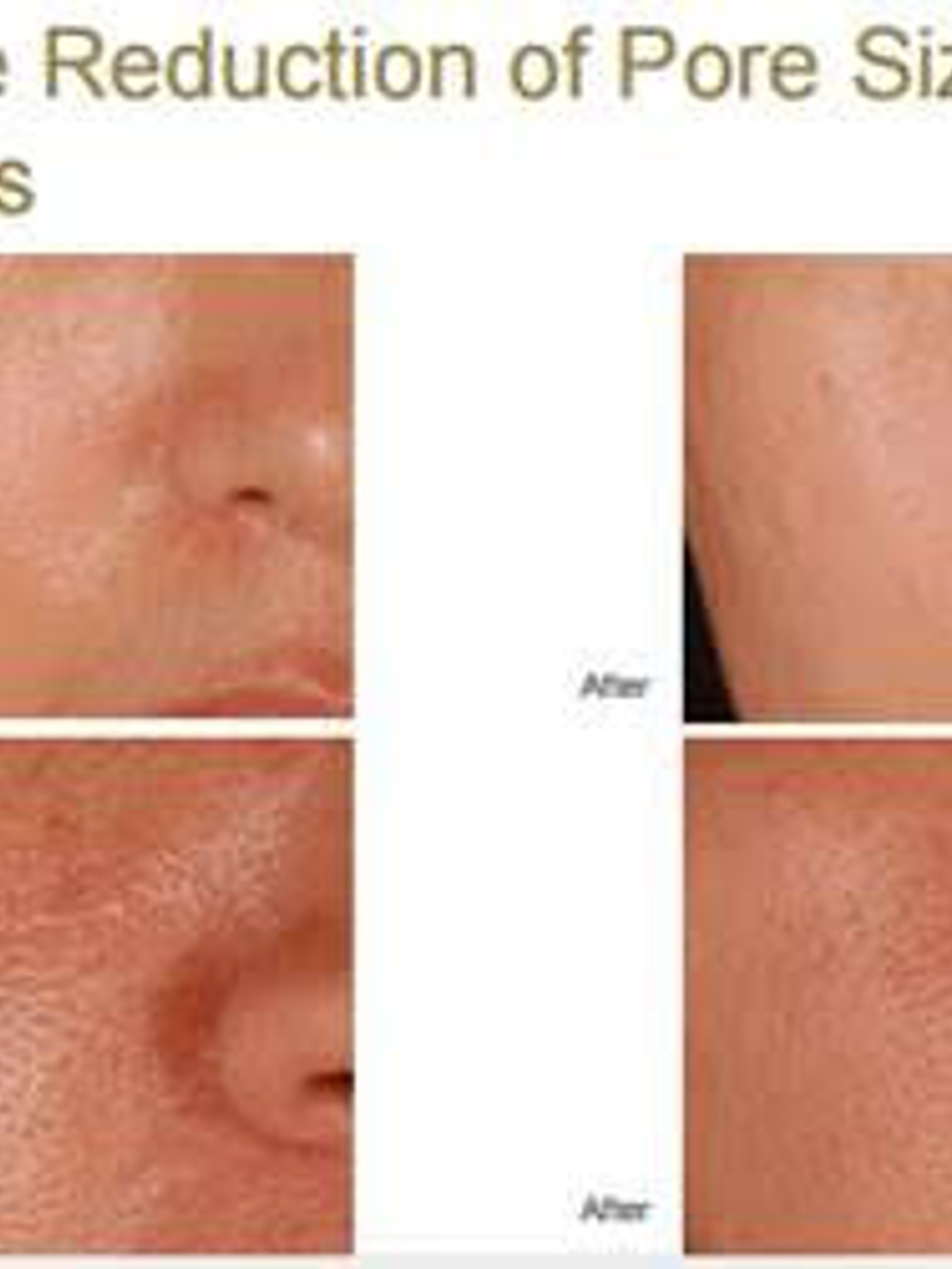 Luminous skin, reduce poros, ilumina y empareja tú piel!! 1