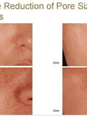 Luminous skin, reduce poros, ilumina y empareja tú piel!!