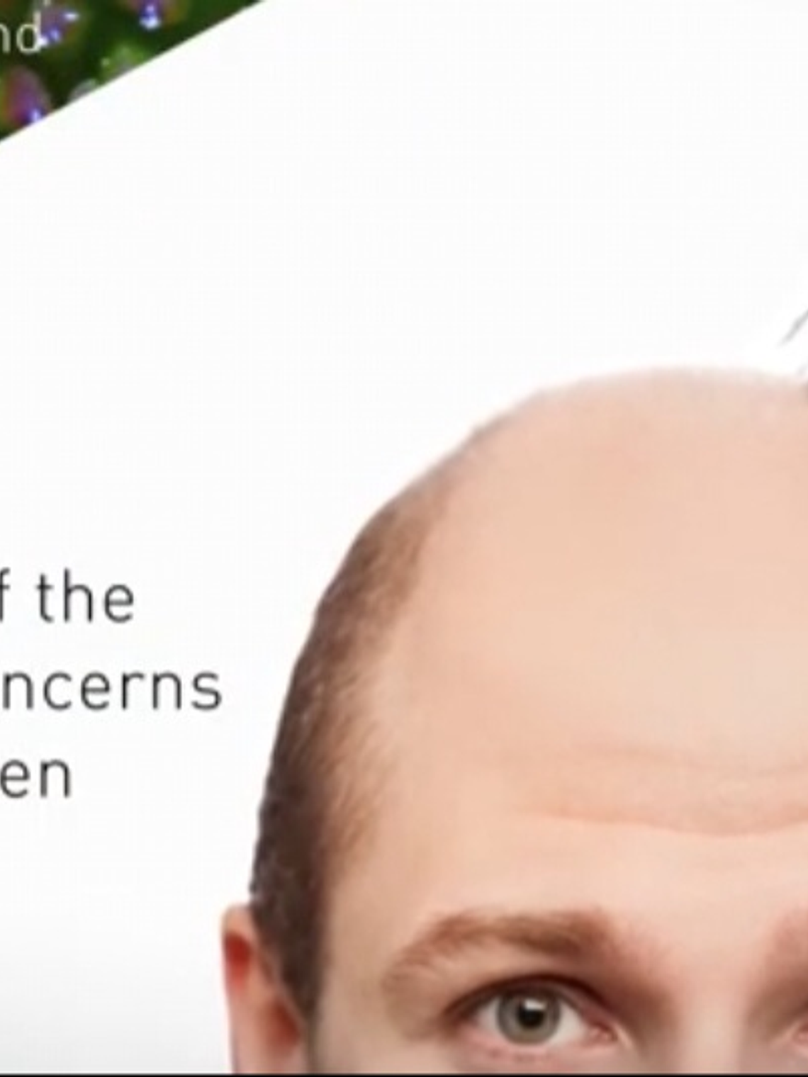 Baicapil 30 Ml Para el crecimiento del cabello 2