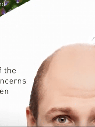 Baicapil 30 Ml Para el crecimiento del cabello