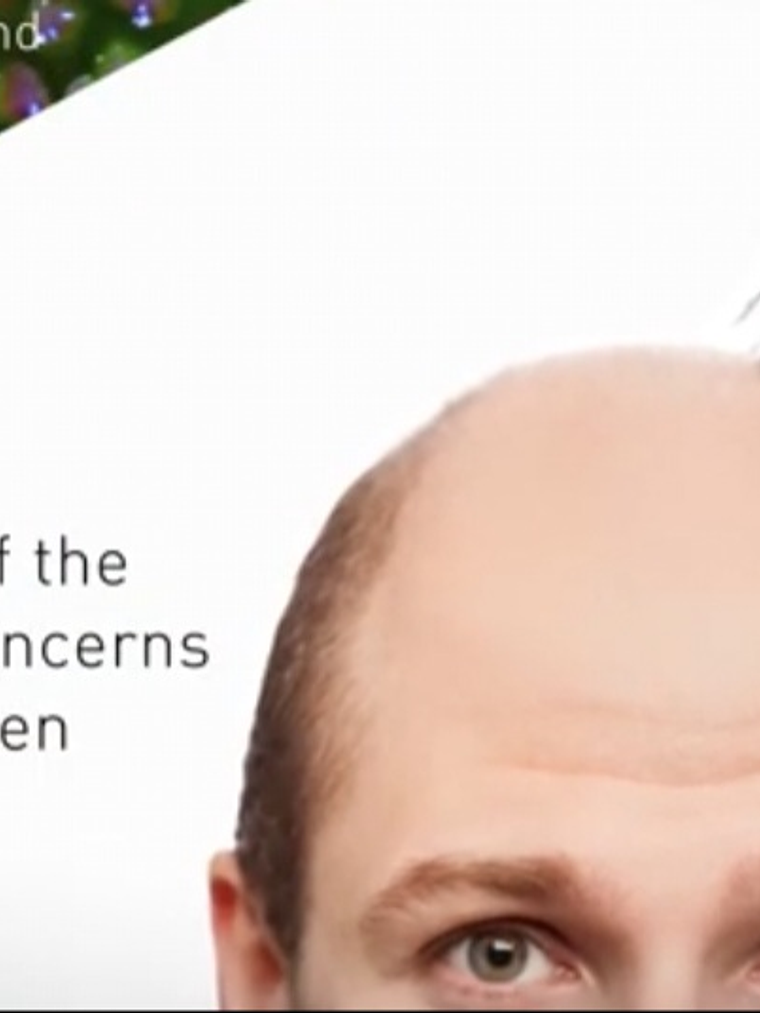 Baicapil 30 Ml Para el crecimiento del cabello 2