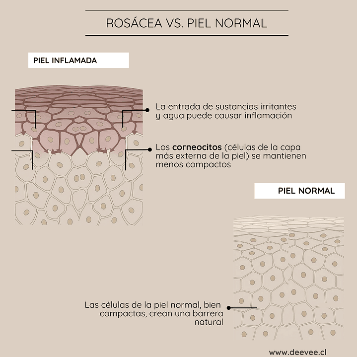 Espuma Limpiadora Facial Rosácea  5