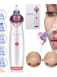 Extractor de Puntos Negros y Espinillas Recargable - Limpieza Facial Profunda LED - Miniatura 2