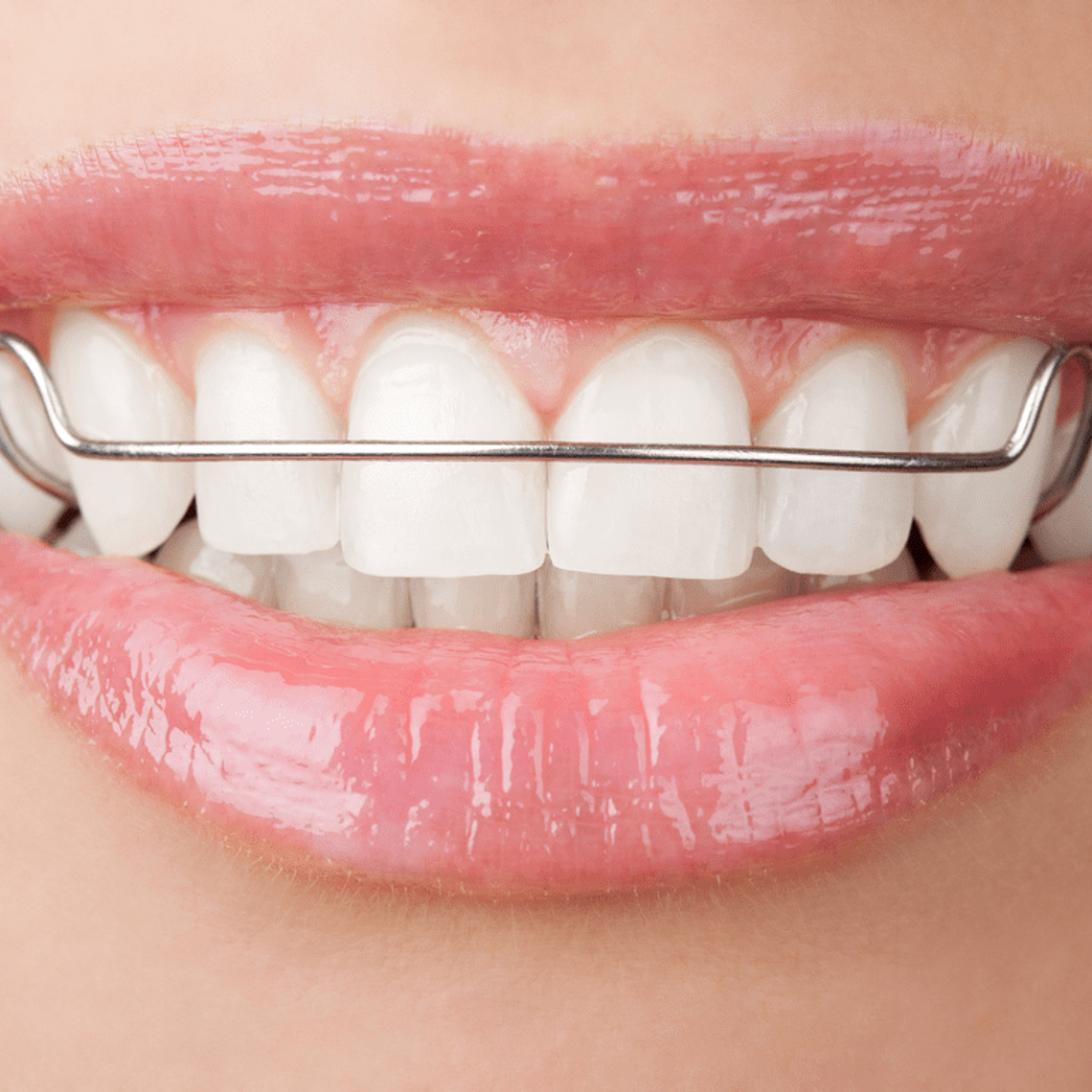 Ortodoncia Interceptiva 1