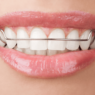 Ortodoncia Interceptiva