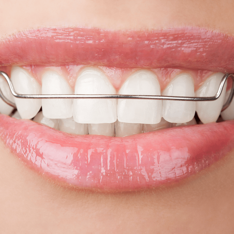 Ortodoncia Interceptiva 1