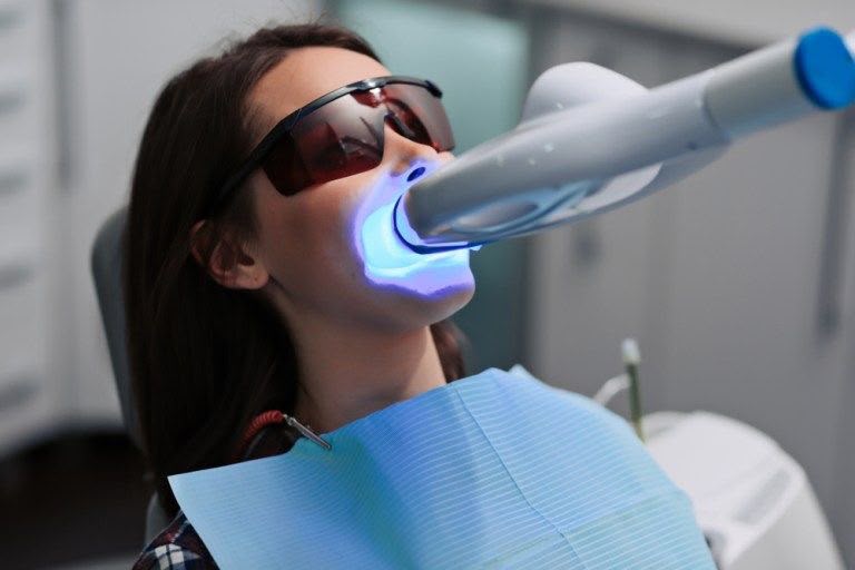 Blanqueamiento Dental en Vitacura: Todo lo que Debes Saber sobre Philips Zoom