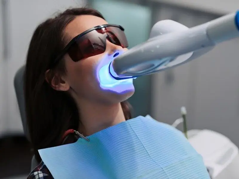 Blanqueamiento Dental en Vitacura: Todo lo que Debes Saber sobre Philips Zoom