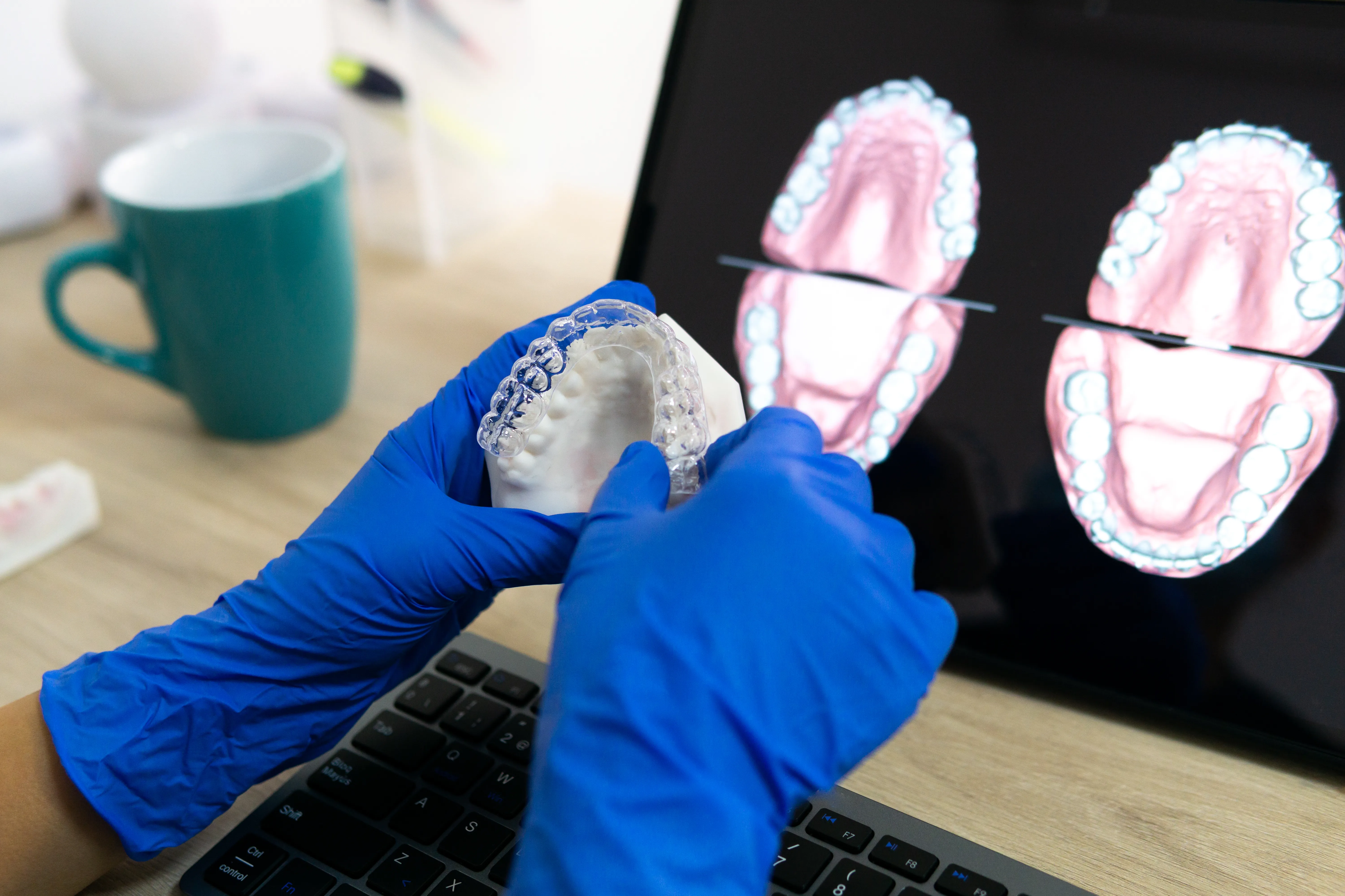 ¿Para Qué Sirve una Tomografía Dental 3D y Cuándo es Necesaria?