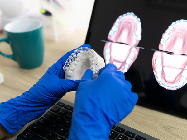 ¿Para Qué Sirve una Tomografía Dental 3D y Cuándo es Necesaria?