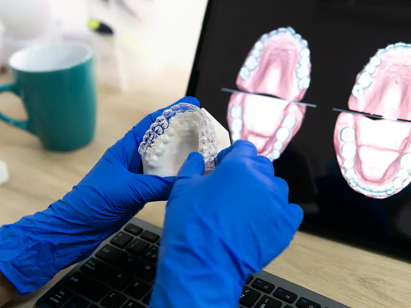 ¿Para Qué Sirve una Tomografía Dental 3D y Cuándo es Necesaria?