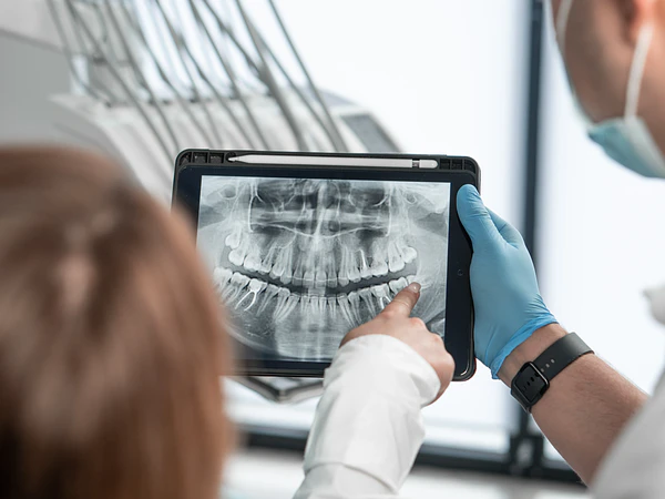 Radiografía Panorámica vs Tomografía Dental: Diferencias y Usos