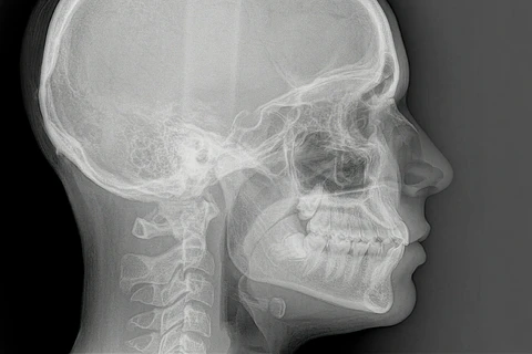 Radiografía extraoral