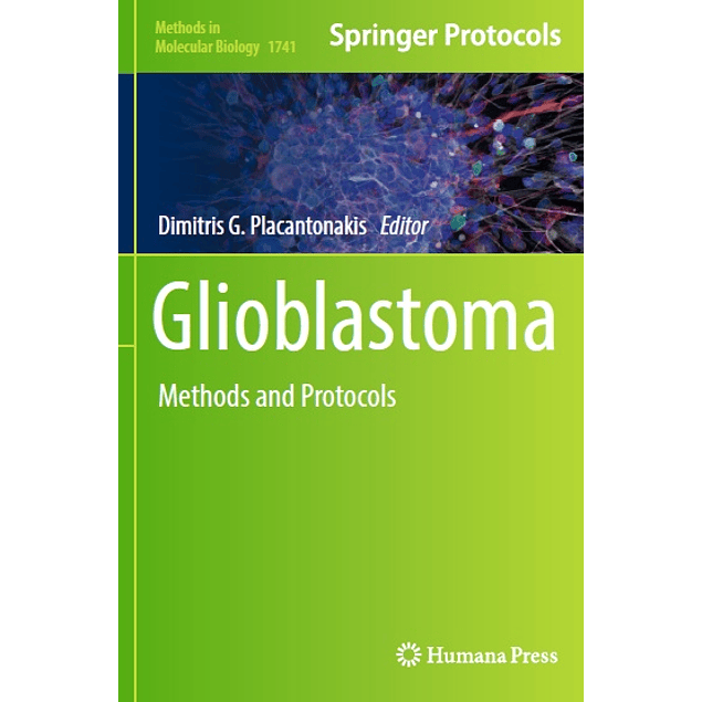 Glioblastoma: Methods and Protocols