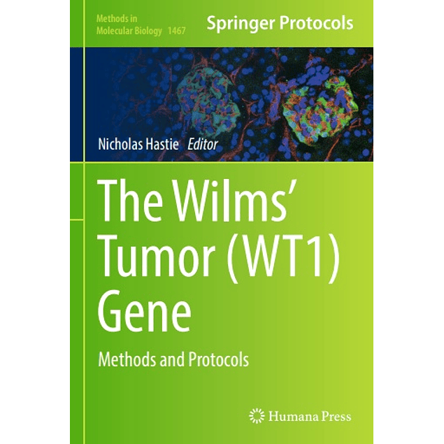 The Wilms' Tumor (WT1) Gene: Methods and Protocols