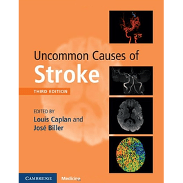 Uncommon Causes of Stroke 