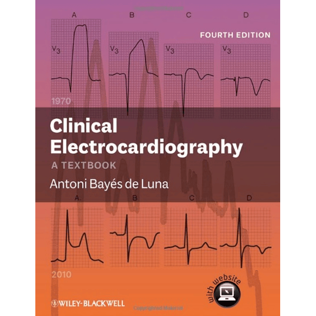 Clinical Electrocardiography: A Textbook