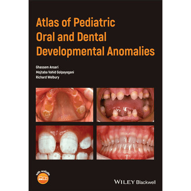  Atlas of Pediatric Oral and Dental Developmental Anomalies 