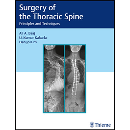 Surgery of the Thoracic Spine: Principles and Techniques