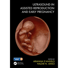 Ultrasound in Assisted Reproduction and Early Pregnancy