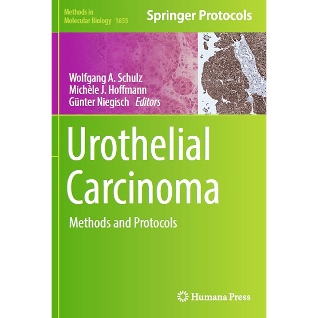 Urothelial Carcinoma: Methods and Protocols