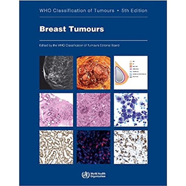Breast Tumours: WHO Classification of Tumours